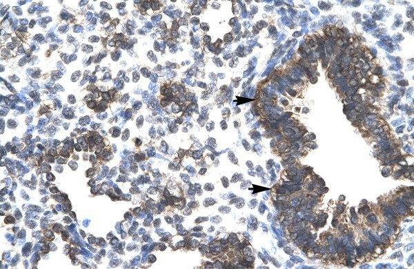 ESRRG antibody