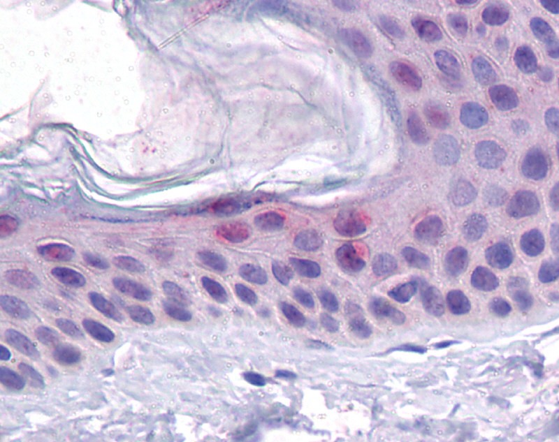 TP53 antibody - N-terminal region