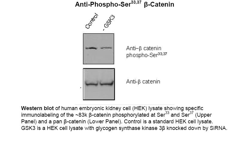 Beta-Catenin (phospho Ser33 / Ser37)Antibody