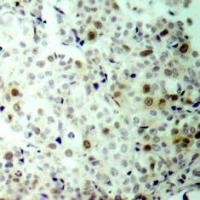 CDK2 (phospho Thr160) Antibody