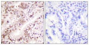Estrogen Receptor-alpha (Phospho-Tyr537) antibody