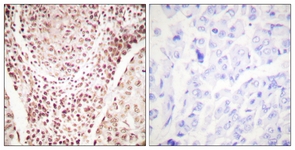 Chk2 (Phospho-Thr387) antibody