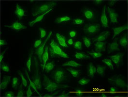 NME2 Antibody (monoclonal) (M09)