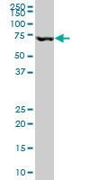 MBD1 Antibody (monoclonal) (M05)