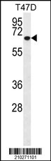 MMP2 Antibody (Ascites)