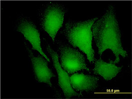 MAPK3 Antibody (monoclonal) (M01)