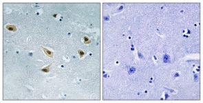 p53 (Phospho-Ser376) antibody