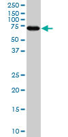 MARCKS Antibody (monoclonal) (M04)