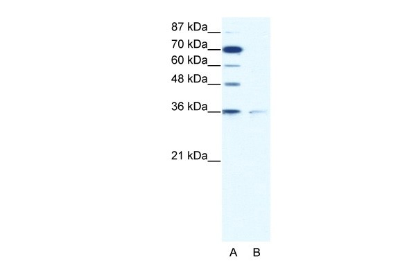 ZNF326 antibody - C-terminal region