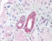 RAF1 Antibody