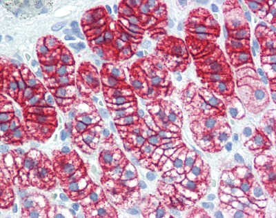 BAD Antibody