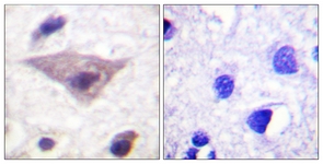 Synuclein (Phospho-Ser129) antibody
