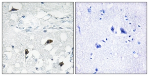 Caspase 3 (Cleaved-Asp175)antibody