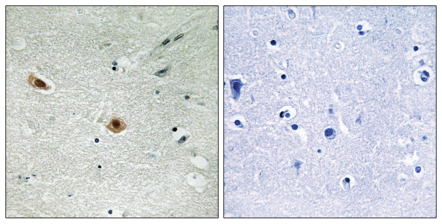 Retinoblastoma (phospho Ser608) Antibody