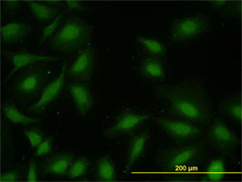 MAPKAPK2 Antibody (monoclonal) (M01)