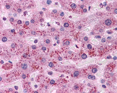 Cyclin D1 Antibody