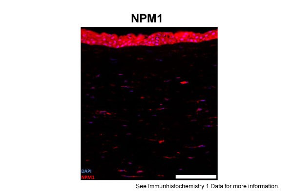 NPM1antibody - C-terminal region