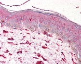 Vimentin Antibody