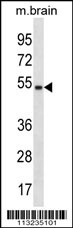 MYC Antibody (C-term T400)