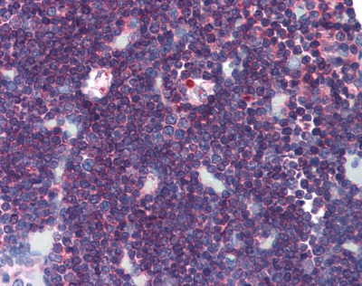 PTPRC Antibody