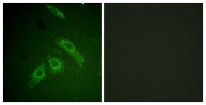 FAK (Phospho-Ser910) antibody