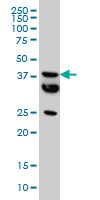 MT Antibody (monoclonal) (M01)