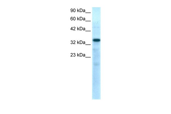 TBX10 antibody - N-terminal region