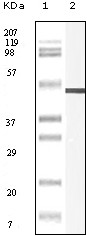 Vimentin Antibody