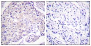 PAK1 (Phospho-Thr212) antibody