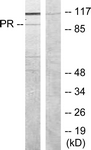 Progesterone Receptor antibody