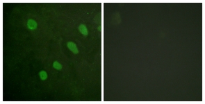 ATF2 (Phospho-Ser480) antibody