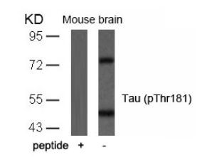 Tau (phospho Thr181) Antibody