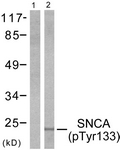 Synuclein-alpha (Phospho-Tyr133) antibody