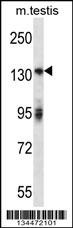 Mouse Erbb2 Antibody