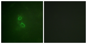 CD227/MUC1 antibody