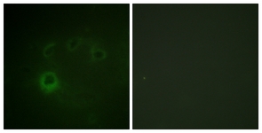 p70 S6 Kinase (Phospho-Ser418) antibody