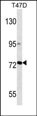 MMP2 Antibody