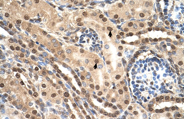 TCEB2 antibody - middle region