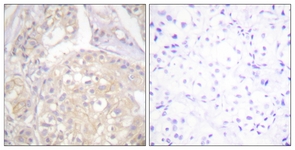 FGFR1 (Phospho-Tyr766) antibody