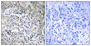 NF-kappaB p65 (Phospho-Thr505) antibody
