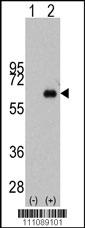 MYC Antibody (S62)
