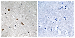 IKK-gamma (Phospho-Ser376) antibody