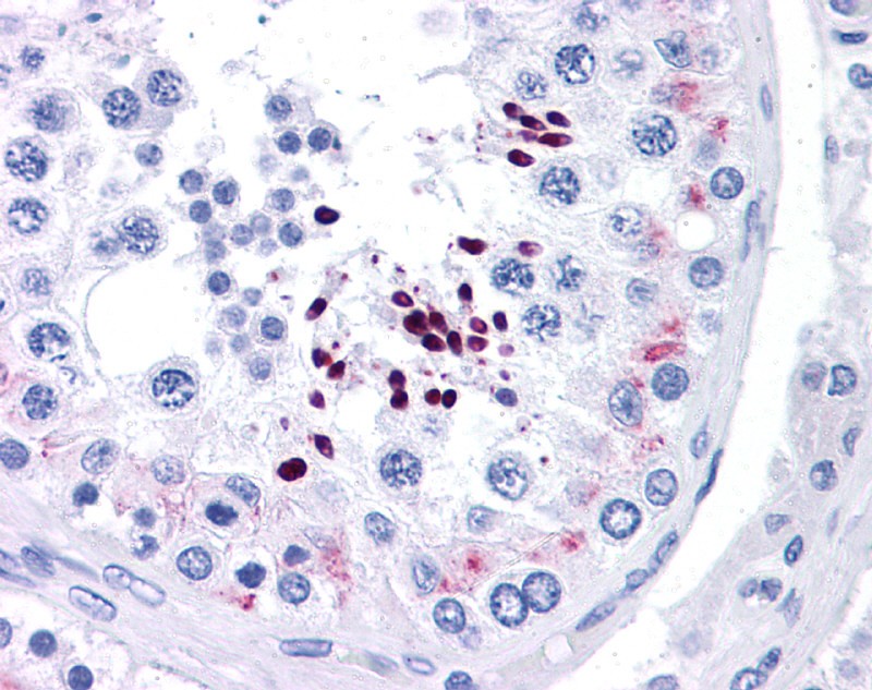 CCND1 antibody - N-terminal region