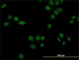 NR1D1 Antibody (monoclonal) (M02)