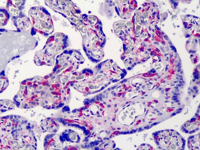 IKK Gamma Antibody