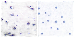 Tau (Phospho-Ser422) antibody