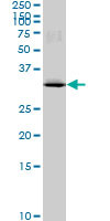 MAD2L1BP Antibody (monoclonal) (M03)