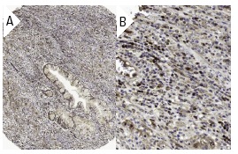 c-Myc Antibody (A-14) FITC