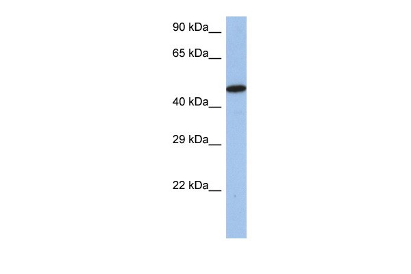 IRF5 antibody - middle region