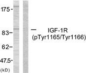 IGF1R (Phospho-Tyr1165/Tyr1166) antibody